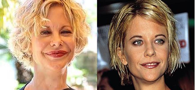 بالصور .. نجوم أتلفوا وجوههم