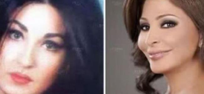 فيديو يُظهر تبدل شكل النجوم قبل وبعد الشهرة