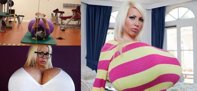 بالصور: صاحبة أكبر نهدين اصطناعيين بالعالم..