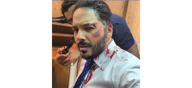 رامي عياش تعرضَ للضرب؟