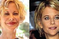 بالصور .. نجوم أتلفوا وجوههم