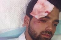 بالصورة تفاصيل تعرض جو صادر للضرب ودخوله الى المستشفى 