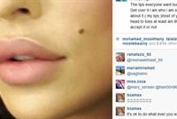 هكذا ردت نادين نجيم على من انتقد شفاهها !