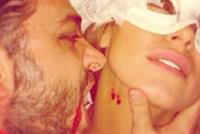 بالصور.. نادين الراسي ضحية مصاص الدماء!