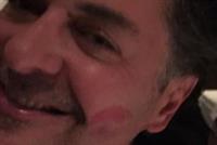 سر القبلة وأحمر الشفاه على خد راغب علامة