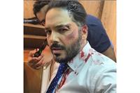 رامي عياش تعرضَ للضرب؟