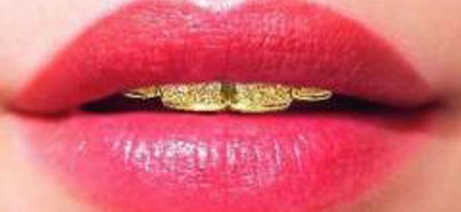 اغلى ابتسامة في العالم بـ153 الف دولار