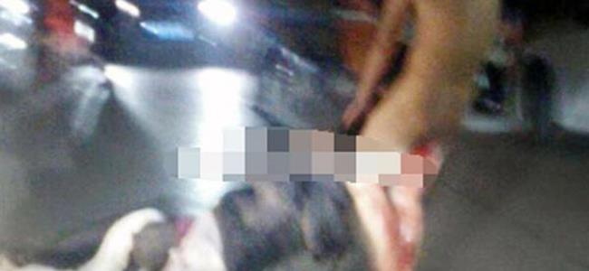 إمرأة تقطع عضو زوجها الذكري..وترميه من شرفة المستشفى