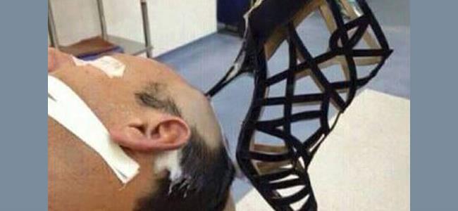 ضربت زوجها على رأسه بنعل حذائها...والنتيجة