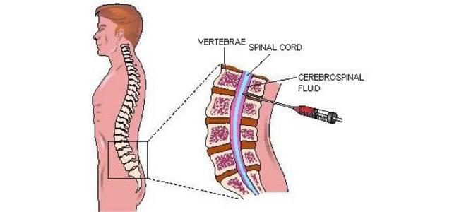 فيروس خطر يهدد اللبنانيين وكلفة العلاج 30 ألف $
