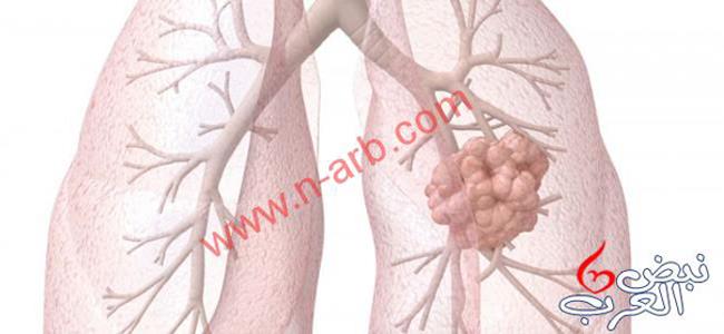إليكم الطعام الوحيد الذى ينظف الرئتين كليا من اثار التدخين ..تعرفوا عليه !!!