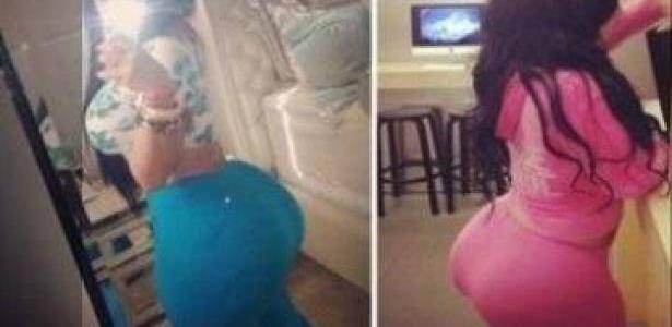 بالصور: شابة تواجه الموت بعد إنفجار مؤخرتها