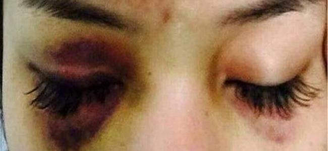 رجل أعمال يعتدي على ممثلة. من هما؟