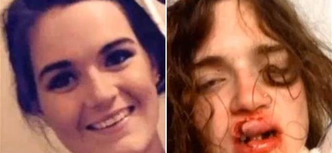  اعتدوا عليها بسبب البيكيني