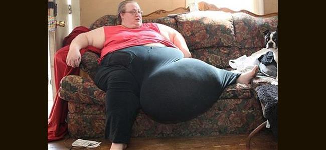  إزالة كتلة وزنها 50 كيلوغرام من بطن سيدة أميركية 