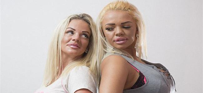  بالصور...والدة تشجع ابنتها على التعري لدفع تكاليف عمليات التجميل 