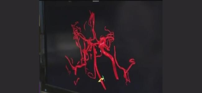 لبناني في عالم الاغتراب يتفوق... طبيّا