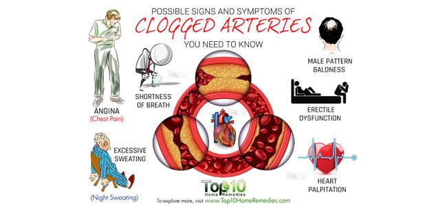10 علامات لانسداد الشرايين.. إياكم تجاهلها!