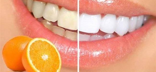 بيّضي أسنانك بـ 60 ثانية فقط... إليك الوصفة الطبيعية!
