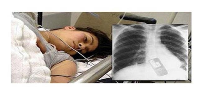 برازيلية تبتلع هاتفها الجوال بسبب...