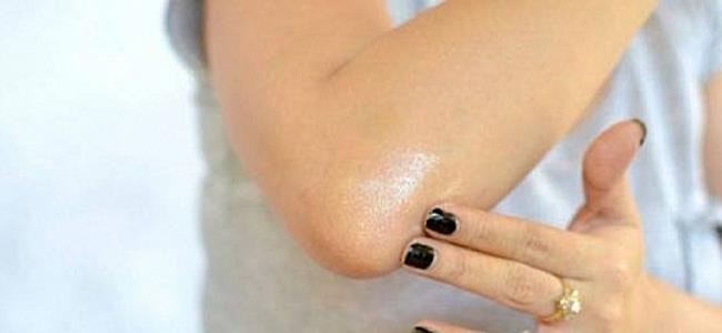 بهذه الطرق البسيطة يمكنك التخلص من اللون الداكن على الكوعين!