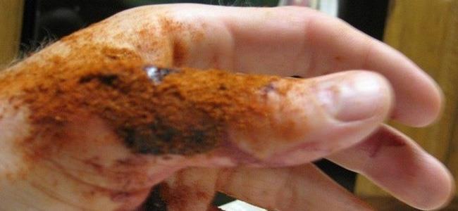 بهذه الطريقة.. تضمد جرحك خلال ثوانٍ