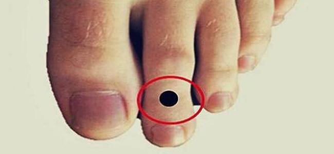 هل إصبع قدمك الثاني أطول من أصابعك الأخرى. إذن عليك أن تقرأ هذا.