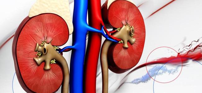 نصائح للوقاية من الفشل الكلوي