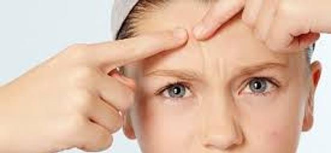 خطوات بسيطة تحميك من ظهور البثور المزعجة