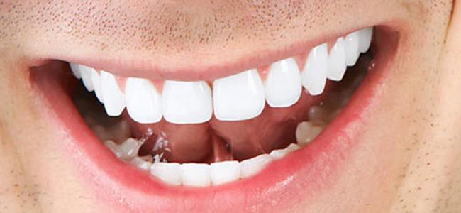 هذه الأخطاء الشائعة قد تدمر أسنانك!