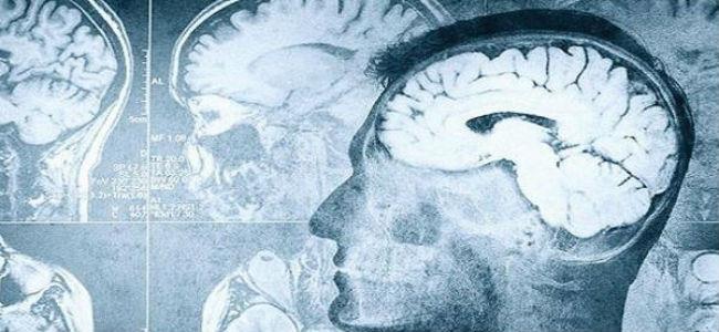 هذه العلاقة بين اضطرابات النوم والذاكرة!