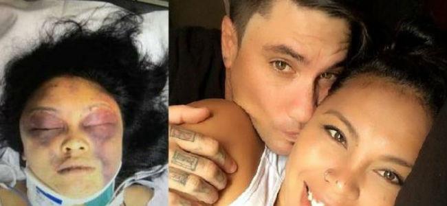  سيلفي تتسبب بنزيف دماغي.. وتعويض يُقّدر بـ70000 دولار