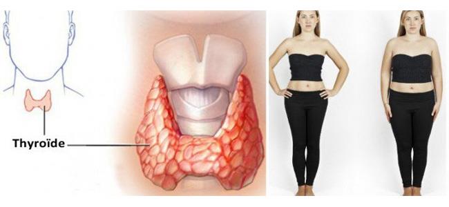  المشروب المعجزة.. 3 أكواب يومياً كفيلة بفقدان 2 كيلو في اليوم