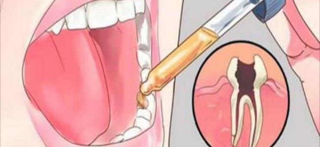 ضعوا هذا الخليط على السنّ.. وسيختفي الألم كالسحر