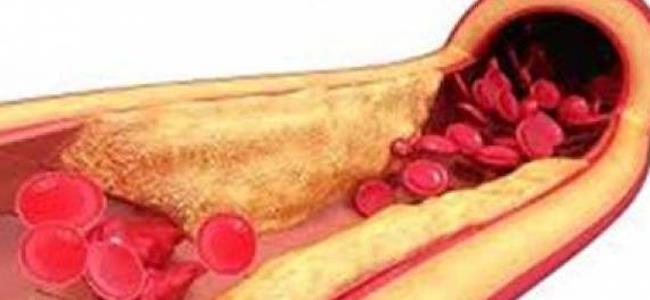 مشروب سحري يفتح الشرايين بصورة مذهلة خلال 20 يوما