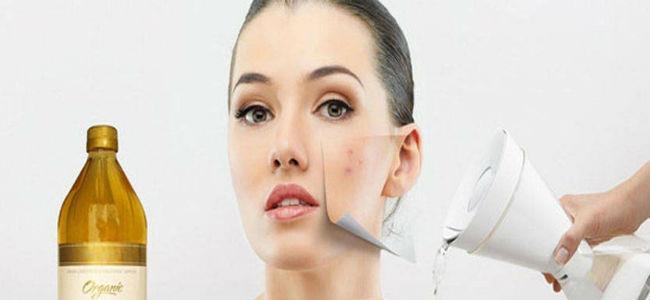  10 استعمالات تجميليّة لخل التفاح.. تعرّفي عليها