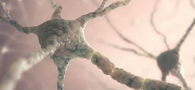 اكتشاف طريقة واعدة لعلاج مرض الزهايمر