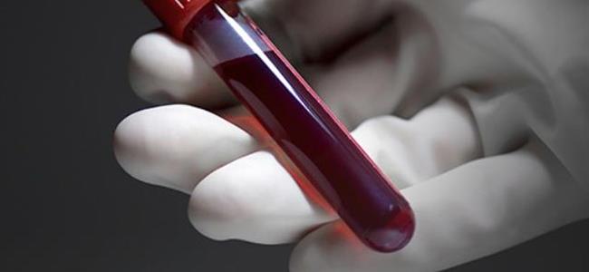 ما هي أخطر فئة دمّ؟