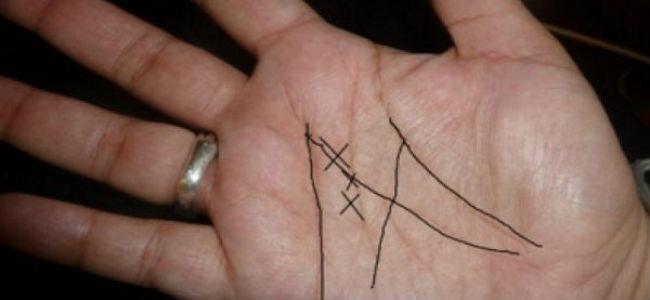 هل يظهر الحرف X  على راحة يدك؟