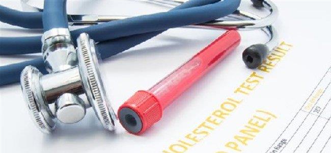  هذا هو معدل الكولسترول الطبيعي!