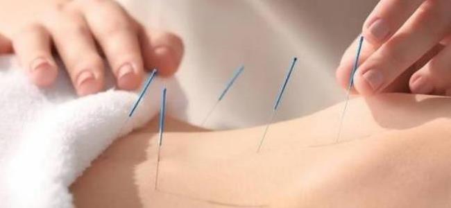 الوخز بالإبر لخسارة الوزن بسرعة فائقة