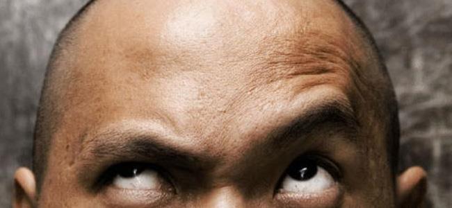 طريقة جديدة لمكافحة الصلع