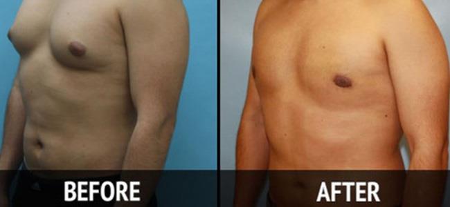  للرجال الذين يعانون من مشكلة 