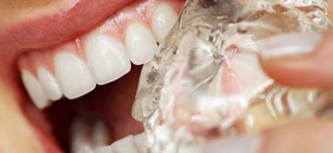 أسرار حماية الأسنان الحساسة من البرودة.. في هذا الخبر! 
