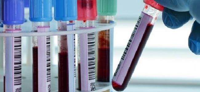  الروس يولّدون الكهرباء من دم الإنسان! 