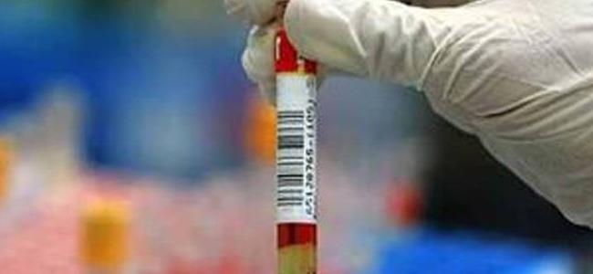  علاج جديد يُبشر بـ