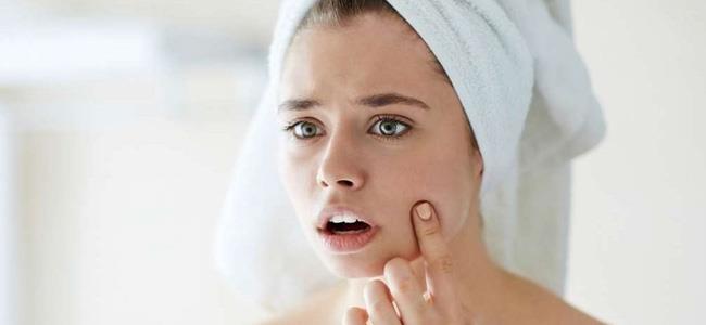 اليك أسهل طريقة للتخلّص من الرؤوس السوداء!