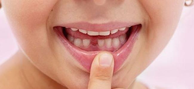  خزني اسنان طفلك بعد وقوعها لأنها قد تنقذ حياته في المستقبل! 