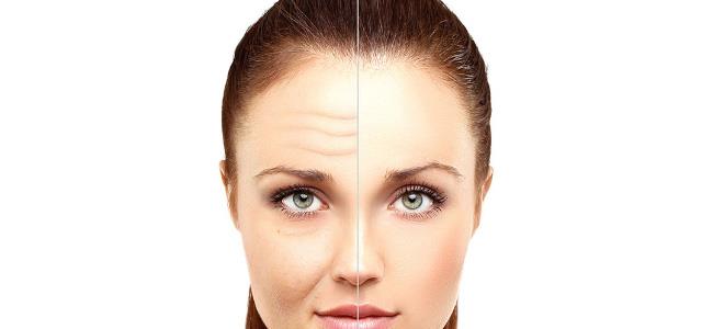 البشرة المترهلّة: ما هي أسبابها وهل يمكن تجنّبها أو معالجتها؟ 