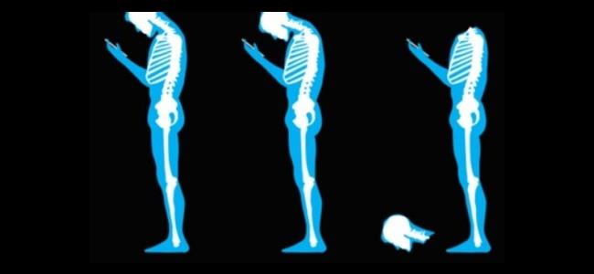  تضغط فقرات الرقبة.. هذا ما تفعله الهواتف بصحتكم 